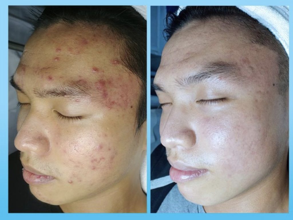Ultimate Lift & Contour Special Facial